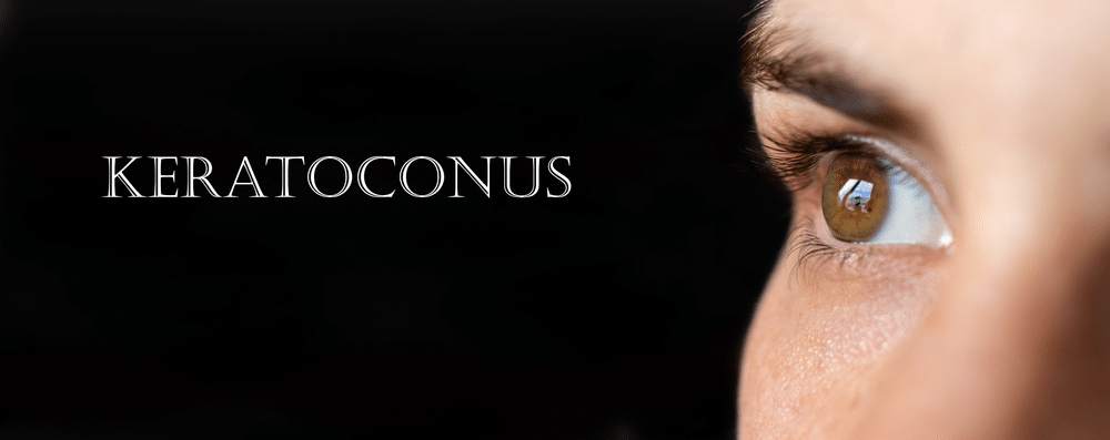 1764966325_ca00c1a433ae4a5ca91c982999a50a2f Corneal Crosslinking in Holly Springs, NC and Fayetteville, NC